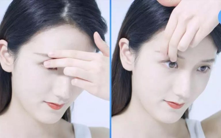 小助手攻略丨超详细OK镜、RGP隐形眼镜摘镜视频来了!