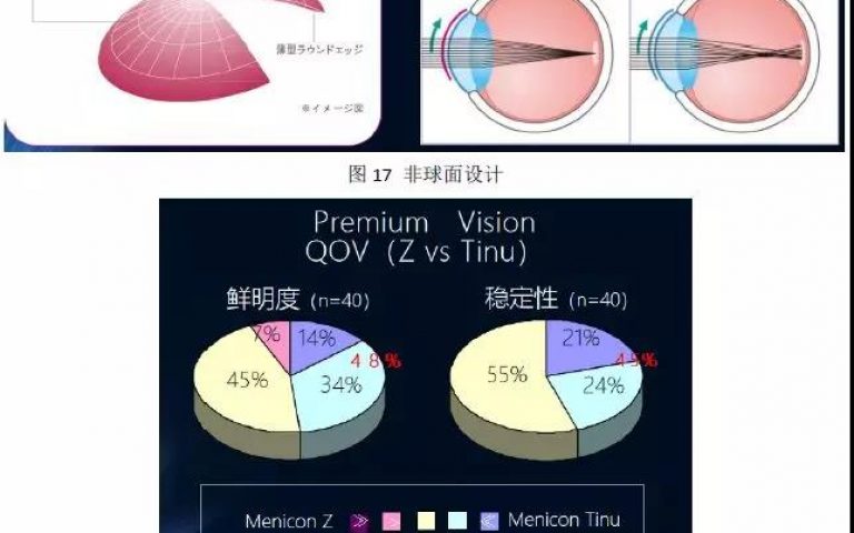 案例小结 | 目立康安氧视与目立康Z的验配方法、视觉效果、配适对比