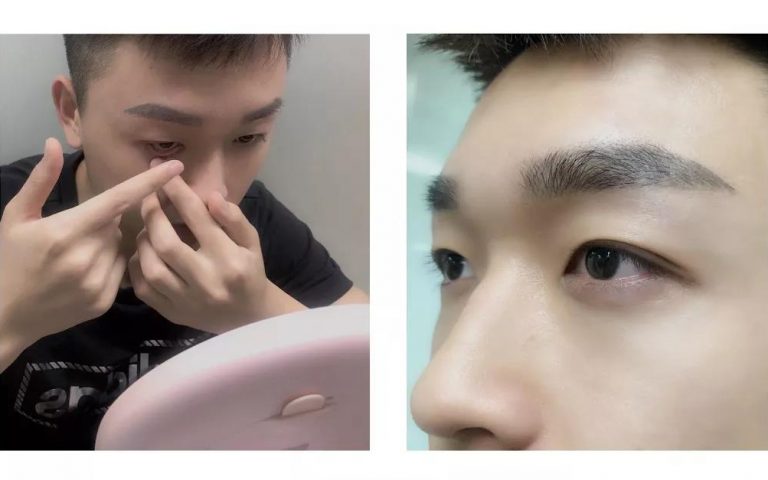 高度近视1500度,为什么选择RGP隐形眼镜?