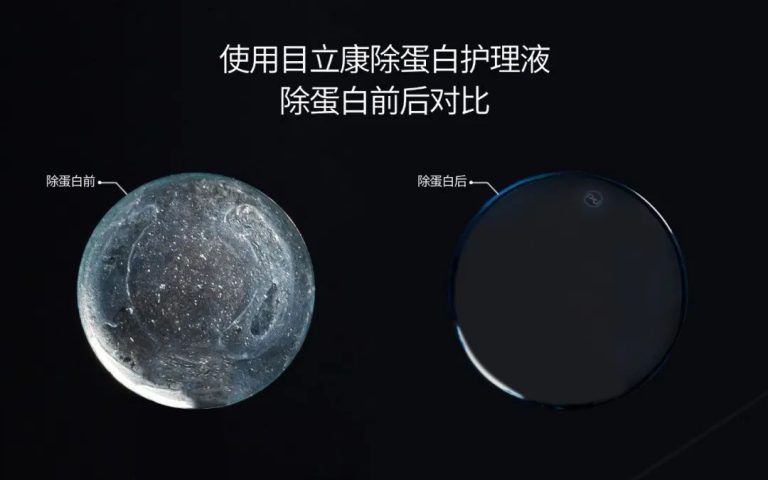 医生提醒,你的镜片该换啦!